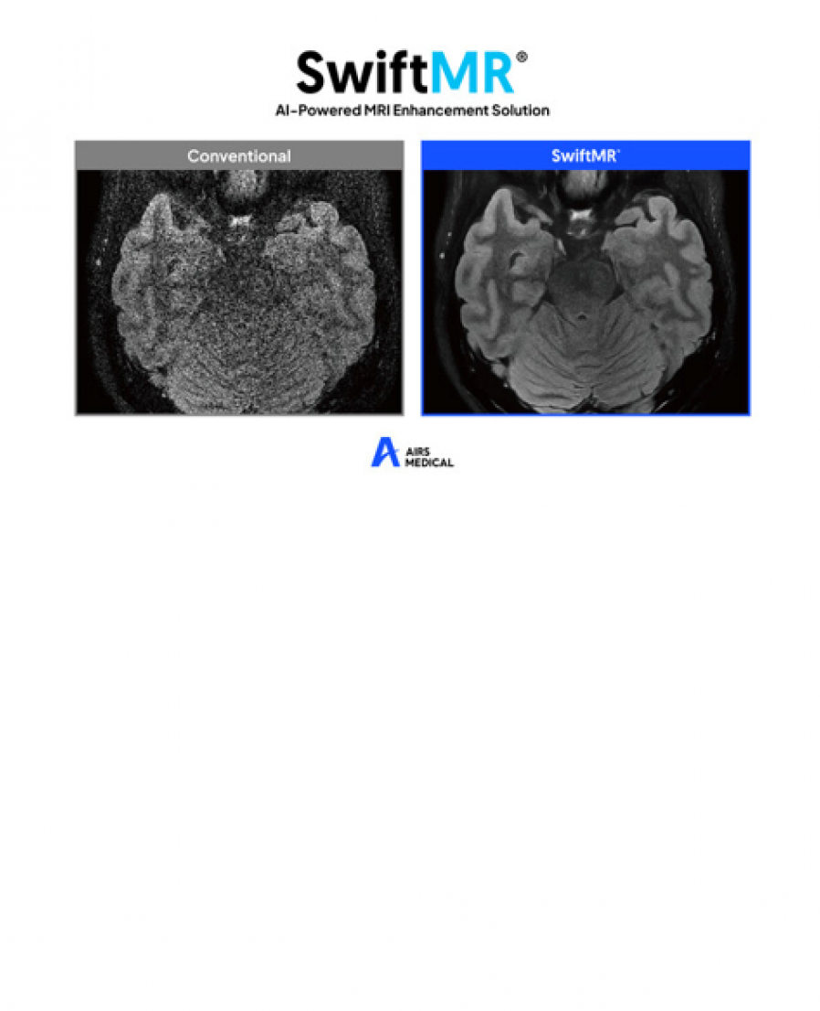 [AIRS Medical] Supplies 'SwiftMR' AI Solution to Seoul National University Hospital